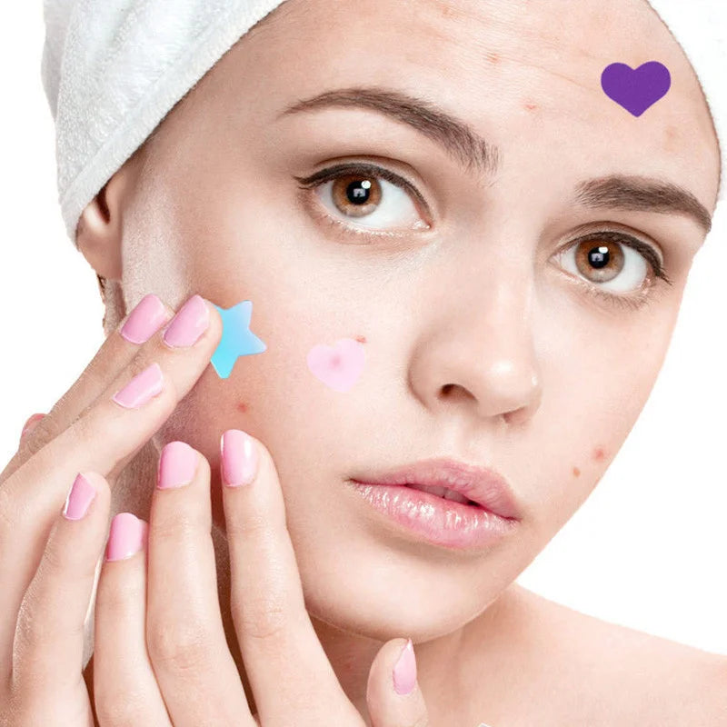 240pcs Colorful Star Love Acne Patch Breathable Waterproof Acne Removal Stickers Invisible Pimple Patch Beauty Skin Care Tool